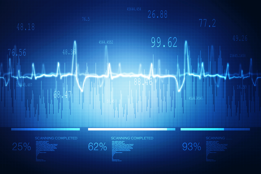 One-in-Four Develop Heart Failure Within Four Years of 1st Heart Attack