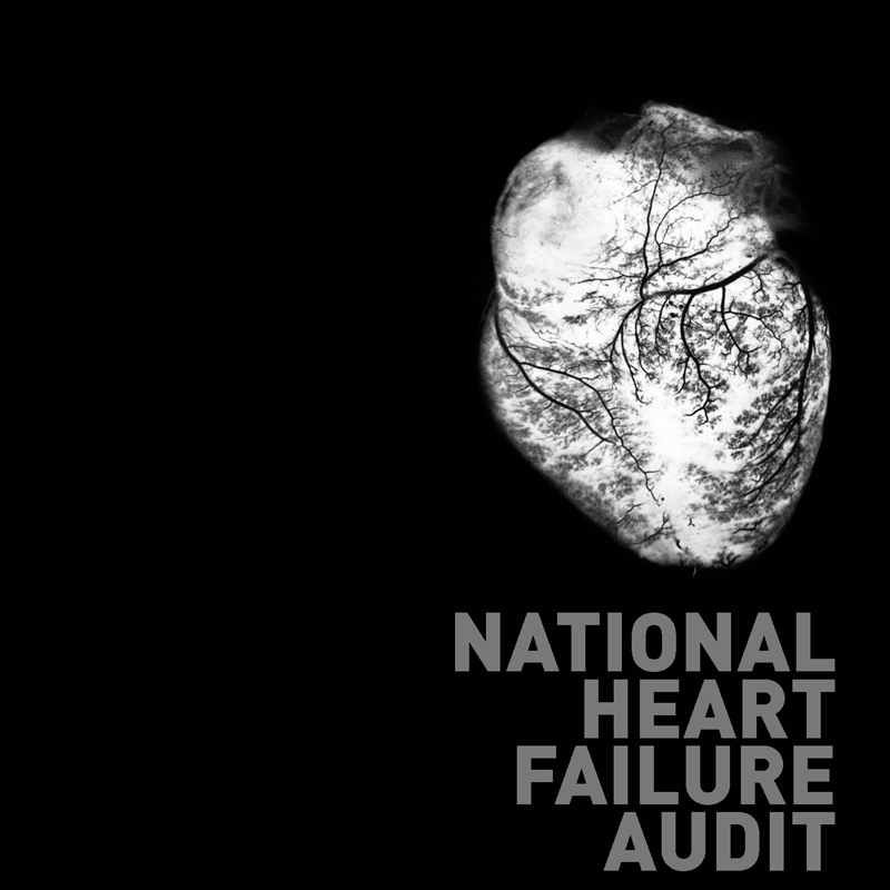 More Patients than Ever Surviving Heart Failure, National Audit Finds